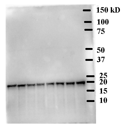 Western blot using anti-HY5 antibodies